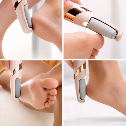 Rechargeable Electric Pedi Foot Filer | Callus Remover For Cracked Heels & Dead Skin